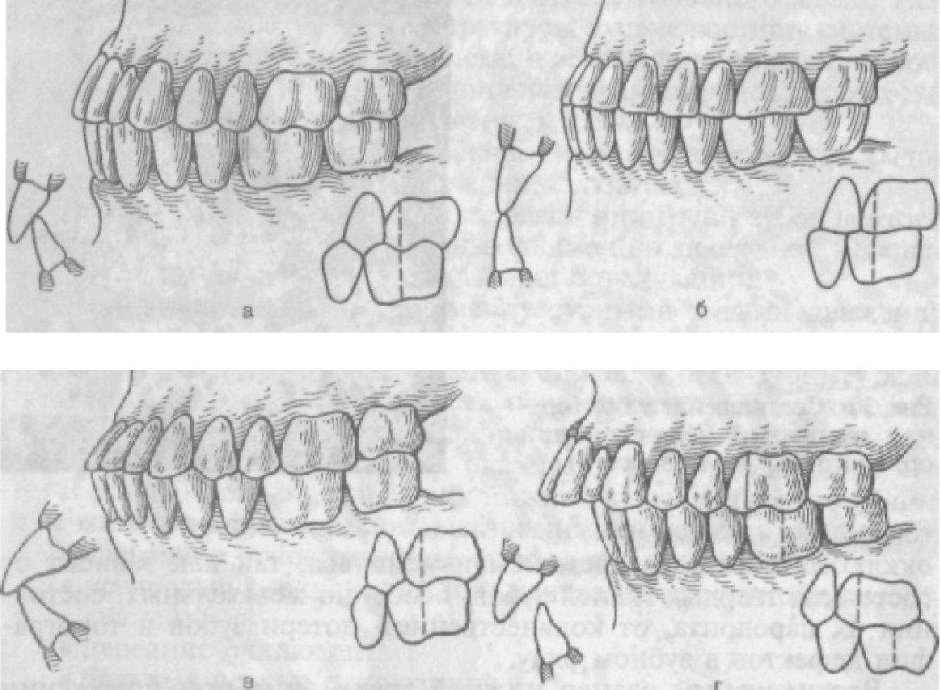 Правильный прикус зубов сбоку