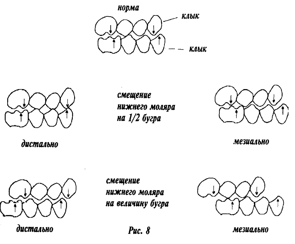 Окклюзионная Каппа сплинт
