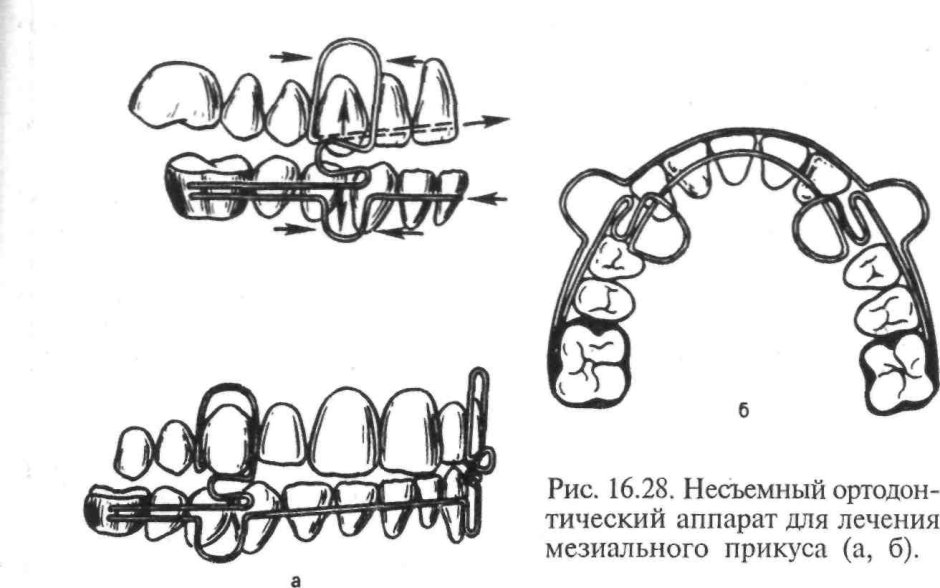Брелок Mongoose LS 9000d