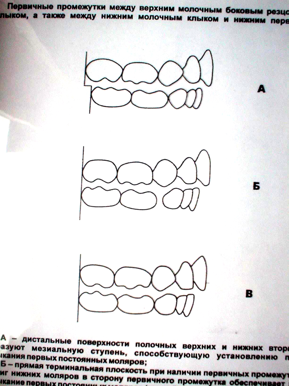 Мезиальный прикус зубов
