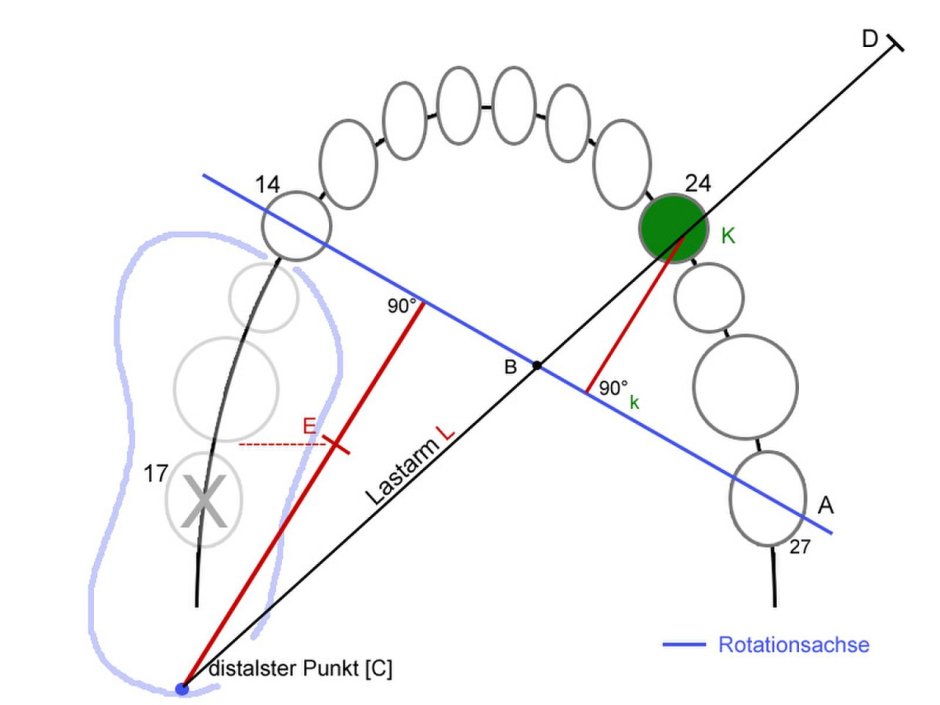 Телерентгенограмма (ТРГ)