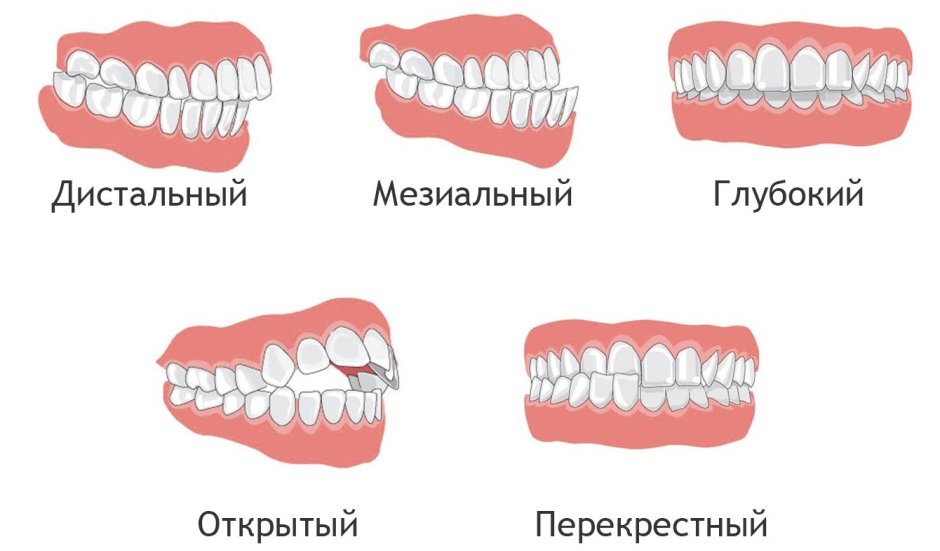 Зуб второй моляр нижней челюсти