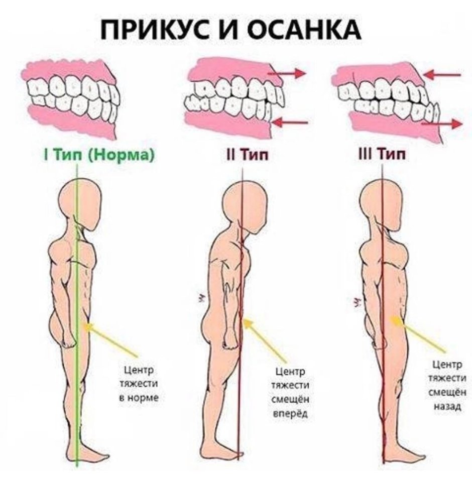 Первый моляр верхней челюсти Бугры