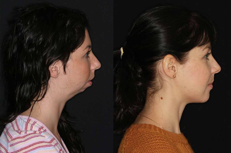 Прикус и осанка взаимосвязь